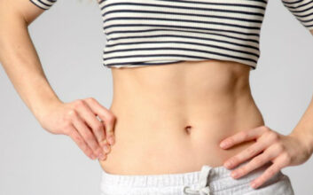 liposuction in Chandigarh