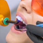 How Laser Dentistry Melbourne Helps to Improve Periodontal Case Management