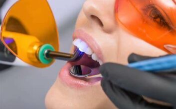 How Laser Dentistry Melbourne Helps to Improve Periodontal Case Management