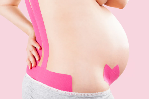 Tape Your Baby Bump—Yay or Nay