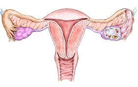 Everything You Need To Know About Enlarged Uterus | UFC