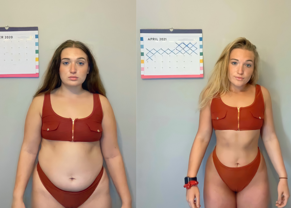6 Week Belly Ozempic Weight Loss Before And After Result