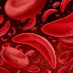 Marrow Failure: When the Body’s Blood Factory Slows Down