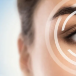 How Long Do LASIK Surgery Results Typically Last