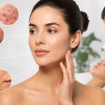 Common Skin Concerns That Need Expert Care
